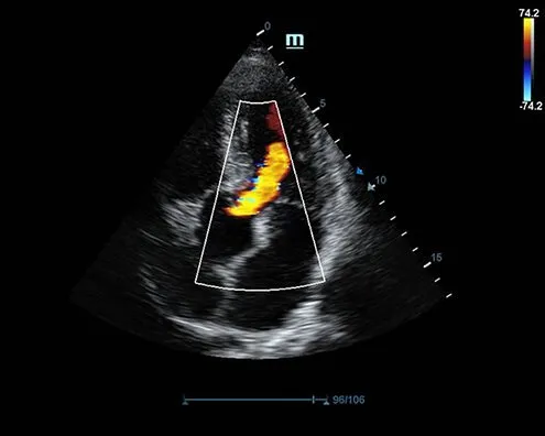 Клинические изображения УЗИ аппарат Mindray DC-70 Exp
