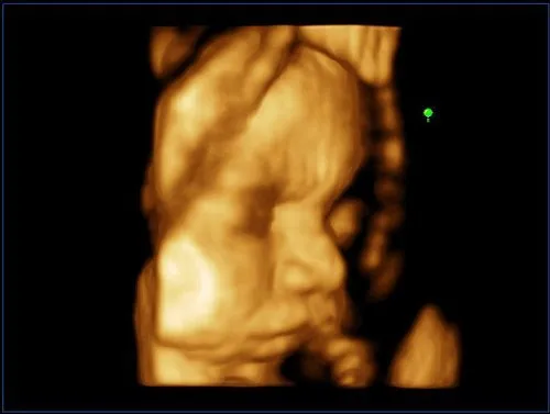 Клинические изображения УЗИ аппарат Esaote MyLab ClassC