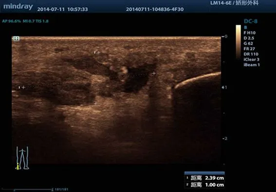 Клинические изображения УЗИ аппарат Mindray DC-8 Exp