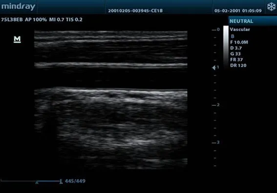 Клинические изображения УЗИ аппарат Mindray DP-10 Vet ветеринарный портативный