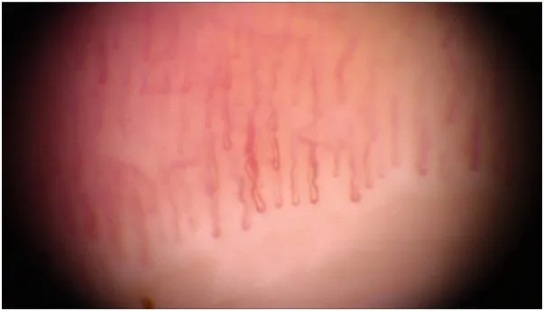 Клинические изображения Аппарат для цифровой дерматоскопии FotoFinder medicam 1000 с док-станцией