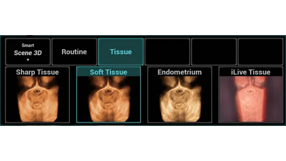 Клинические изображения УЗИ аппарат Mindray Imagyn I9