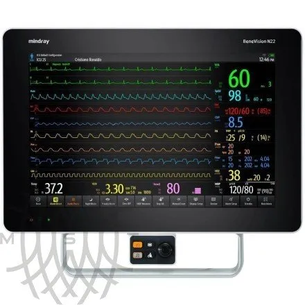 Монитор пациента Mindray BeneVision N22