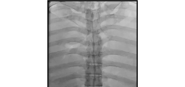 Клинические изображения С-дуга Philips Zenition 30