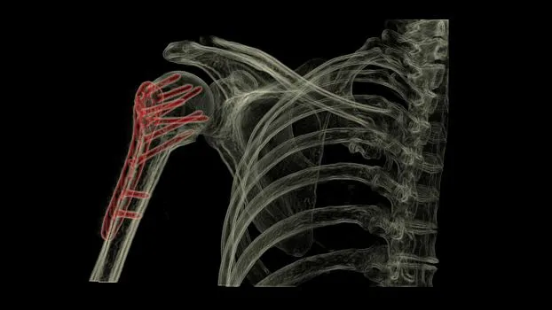 Клинические изображения Brivo XR575 цифровой рентгенографический аппарат GE HealthCare