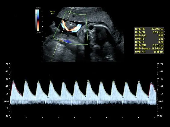 Клинические изображения УЗИ аппарат GE HealthCare Voluson E8 