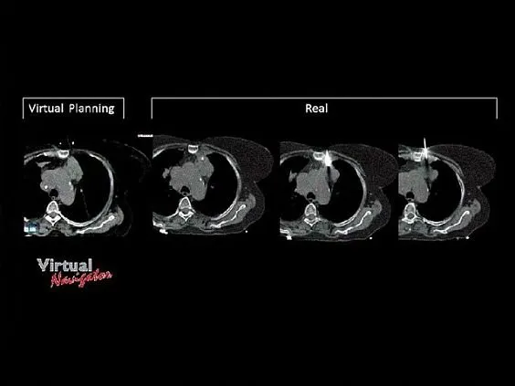 Клинические изображения УЗИ аппарат Esaote MyLab Eight