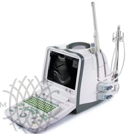 УЗИ аппарат Mindray DP-6900 портативный