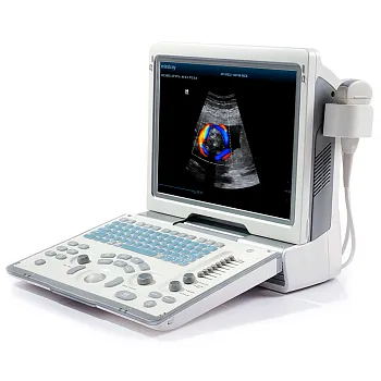 УЗИ аппарат Mindray DP-50 Color портативный
