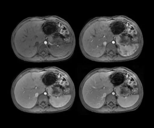 Клинические изображения МРТ аппарат GE SIGNA Architect 3T