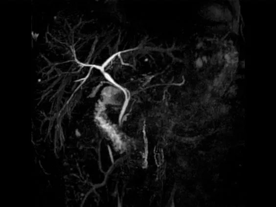 Клинические изображения Магнитно-резонансный томограф GE HealthCare Optima MR450w