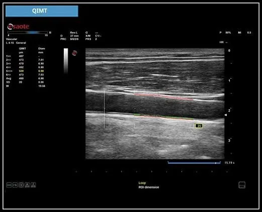 Клинические изображения УЗИ аппарат Esaote MyLab X5