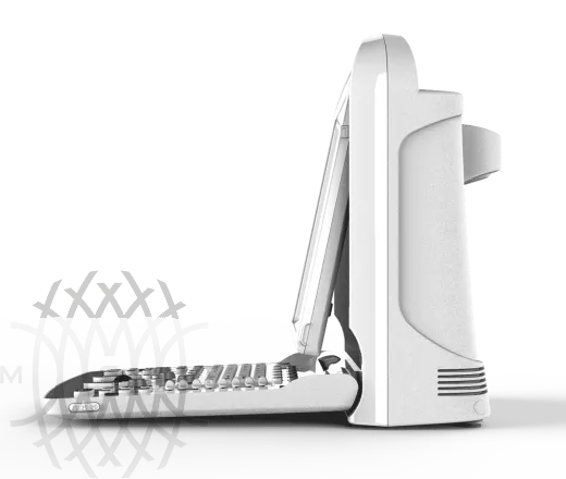 Chison SonoTouch 20 УЗИ аппарат портативный