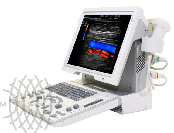 УЗИ аппарат Mindray Z6 портативный