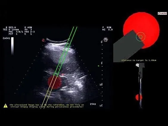 Клинические изображения УЗИ аппарат Esaote MyLab Eight