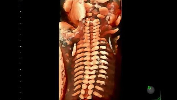 Клинические изображения GE HealthCare Voluson Signature 20 УЗИ аппарат