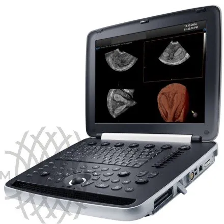 Samsung Medison HM70 EVO УЗИ аппарат портативный