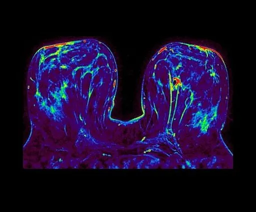 Клинические изображения МРТ аппарат GE SIGNA Architect 3T