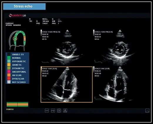 Клинические изображения УЗИ аппарат Esaote MyLab X6