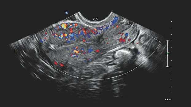 Клинические изображения Philips 5500 ультразвуковой аппарат портативный