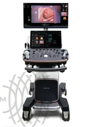 УЗИ аппарат Mindray Imagyn I9