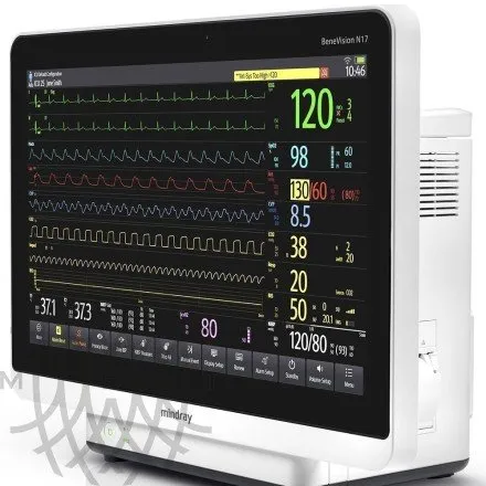 Монитор пациента Mindray BeneVision N17