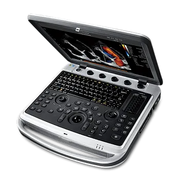 УЗИ аппарат Chison SonoBook 8 портативный