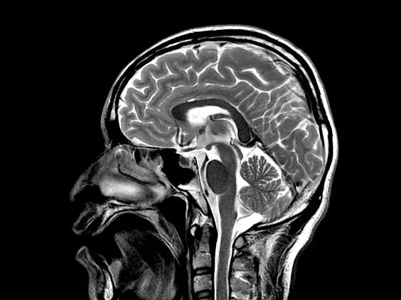 Клинические изображения Магнитно-резонансный томограф GE HealthCare Optima MR450w