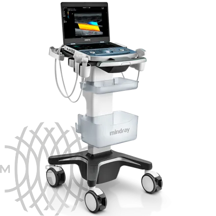 Портативный УЗИ аппарат Mindray MX8 Exp
