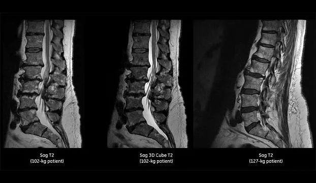Клинические изображения МРТ аппарат GE SIGNA Voyager 1.5T