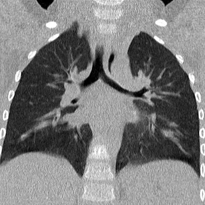 Клинические изображения Siemens SOMATOM go.All компьютерный томограф 