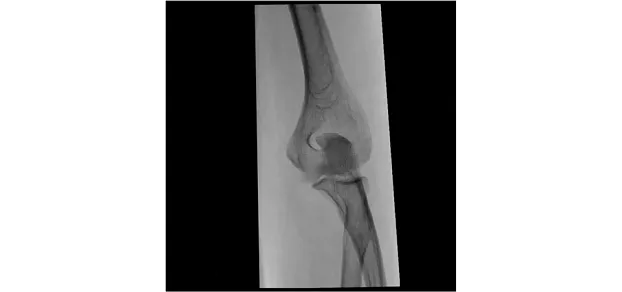 Клинические изображения С-дуга Philips Zenition 30