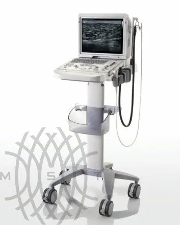 УЗИ аппарат Mindray Z6 портативный