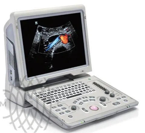 УЗИ аппарат Mindray Z6 портативный