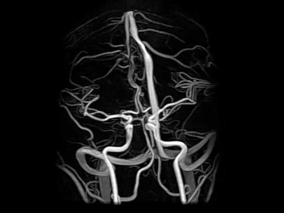 Клинические изображения Магнитно-резонансный томограф GE HealthCare Optima MR450w