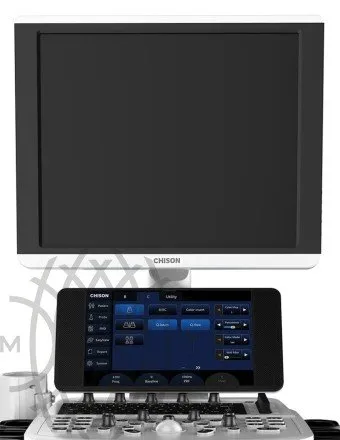 Chison Qbit 6 ультразвуковой аппарат