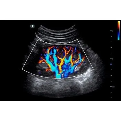 Клинические изображения УЗИ аппарат Mindray DC-70S