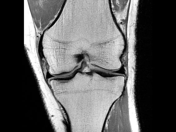 Клинические изображения Магнитно-резонансный томограф GE HealthCare Optima MR450w