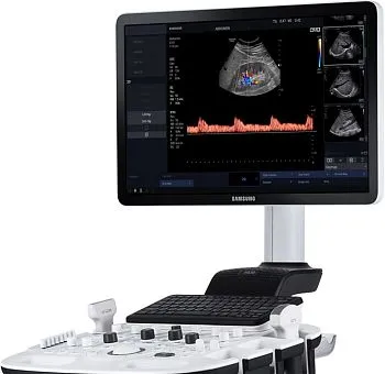 Samsung Medison HS30 УЗИ аппарат