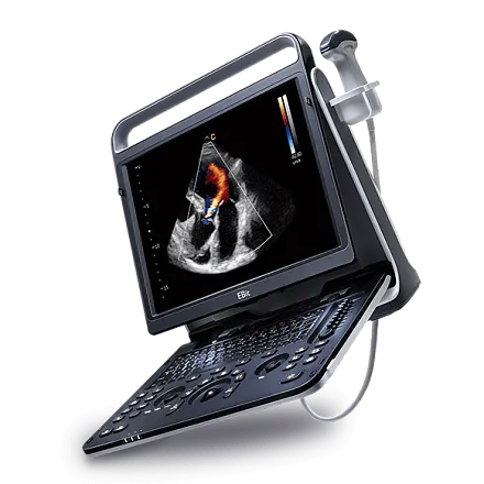 Chison EBit 60 аппарат УЗИ