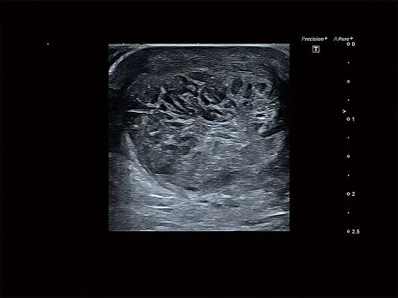 Клинические изображения Canon (Toshiba) Aplio a550 аппарат УЗИ