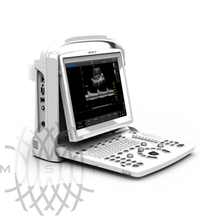 УЗИ аппарат Chison ECO 3 Expert