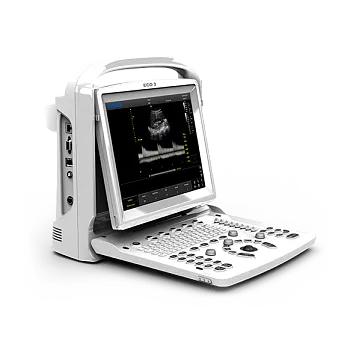 УЗИ аппарат Chison ECO 3 Expert