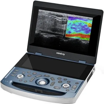 УЗИ аппарат Mindray MX7 Exp портативный