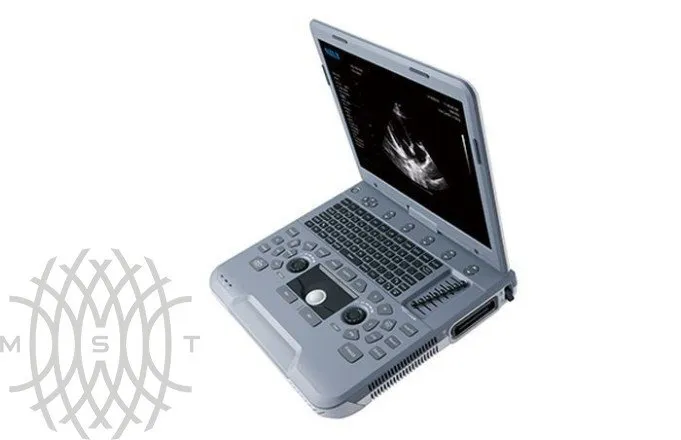 УЗИ аппарат SIUI Apogee 1000 Neo