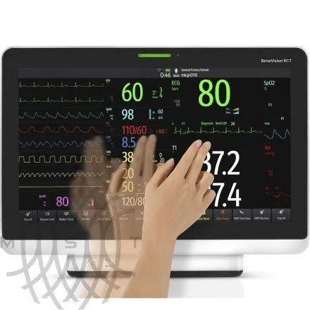 Монитор пациента Mindray BeneVision N17
