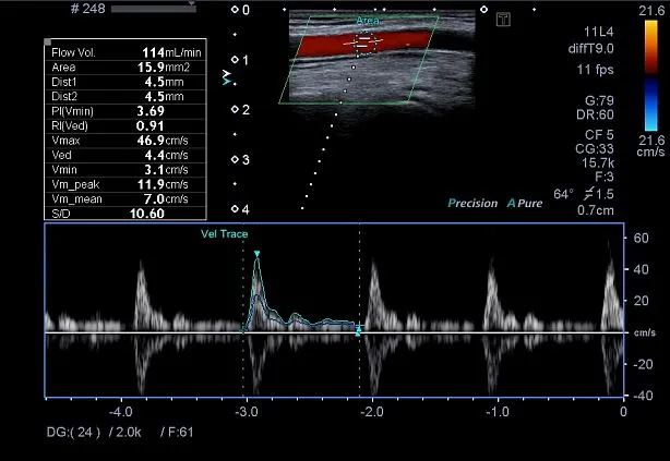 Клинические изображения Canon Xario 100 ультразвуковой аппарат