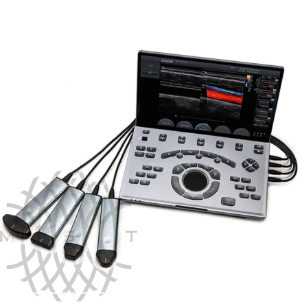 УЗИ аппарат Chison SonoTouch 50 (Sonoair) портативный