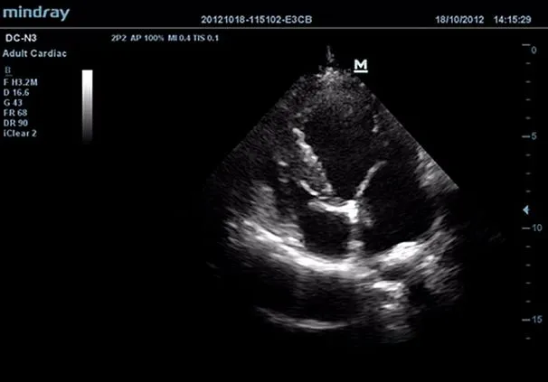 Клинические изображения УЗИ аппарат Mindray DC-N3 Vet портативный ветеринарный 
