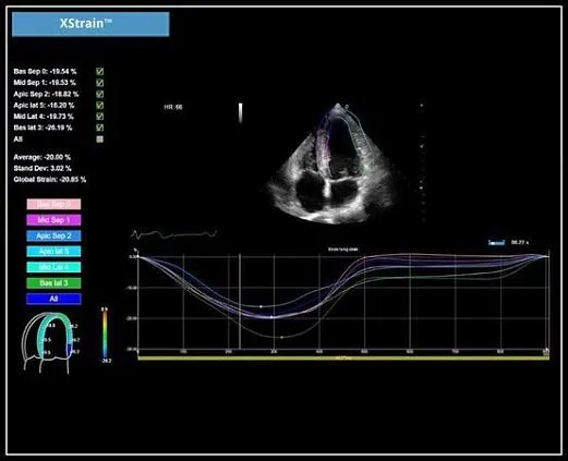 Клинические изображения УЗИ аппарат Esaote MyLab X5
